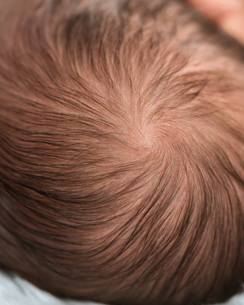 salon and cure for baby hair loss
