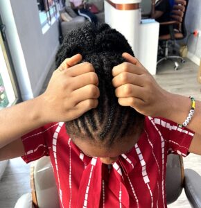 image of itchy scalp