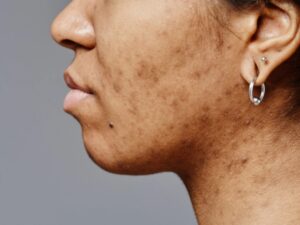 face reaction to harsh hair and face products